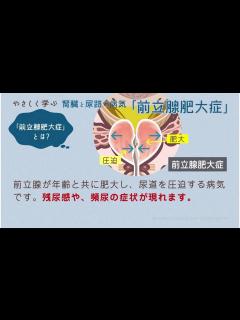 [x]やさしく学ぶ－泌尿器の病気 前立腺肥大症 - YouTube
