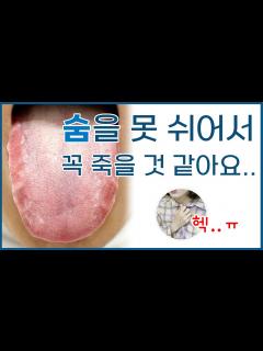 [x]호흡곤란/ 자려고 누우면 숨이 막혀서 죽을 것 같아요 - YouTube